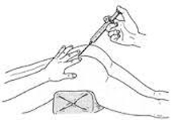 うつ伏せになって手術を受ける様子